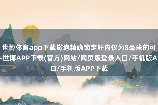 世博体育app下载微泡精确锁定肝内仅为8毫米的可疑病灶-世博APP下载(官方)网站/网页版登录入口/手机版APP下载